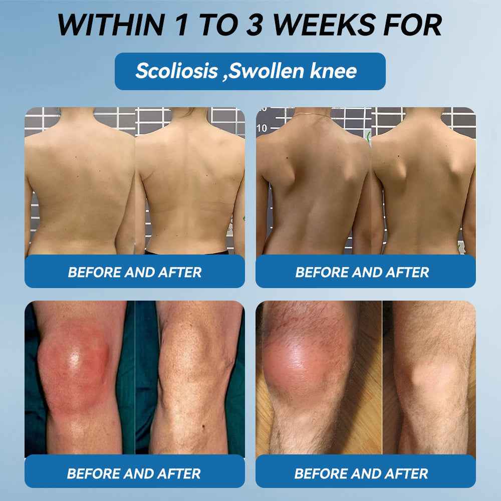 𝖯𝗂𝖼𝗱𝗼®🦹🦹 BPC-157 Joint Healing Cream🦴Treats Arthritis, Neuropathy, Rheumatism, Sports Injuries & More👍