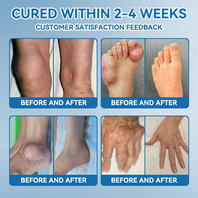 𝖯𝗂𝖼𝗱𝗼®🦹🦹 BPC-157 Joint Healing Cream🦴Treats Arthritis, Neuropathy, Rheumatism, Sports Injuries & More👍