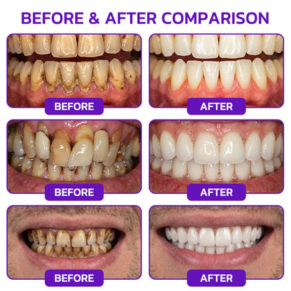 🎁GLIMMERLY® VioCore Bee Venom Gingivitis & Periodontitis Treatment Toothpaste（副本）
