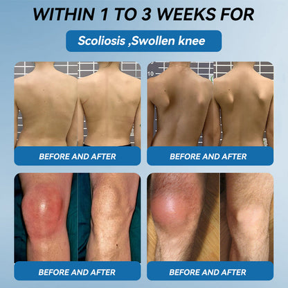 𝖯𝗂𝖼𝗱𝗼®🦹🦹 BPC-157 Joint Healing Cream🦴Treats Arthritis, Neuropathy, Rheumatism, Sports Injuries & More👍