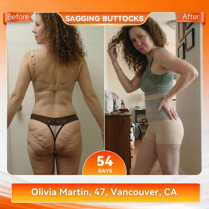 PAURAJU® 🍚✈️30-Min All-in-One Micro-Particle Fat-Burning Shorts✅Ignites deep microcirculation to melt fat, flush toxins, and reverse metabolic aging.