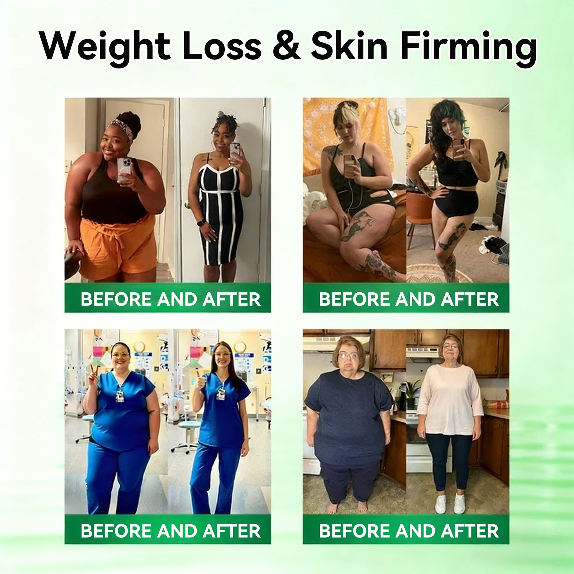 Body shaping and skin firming support