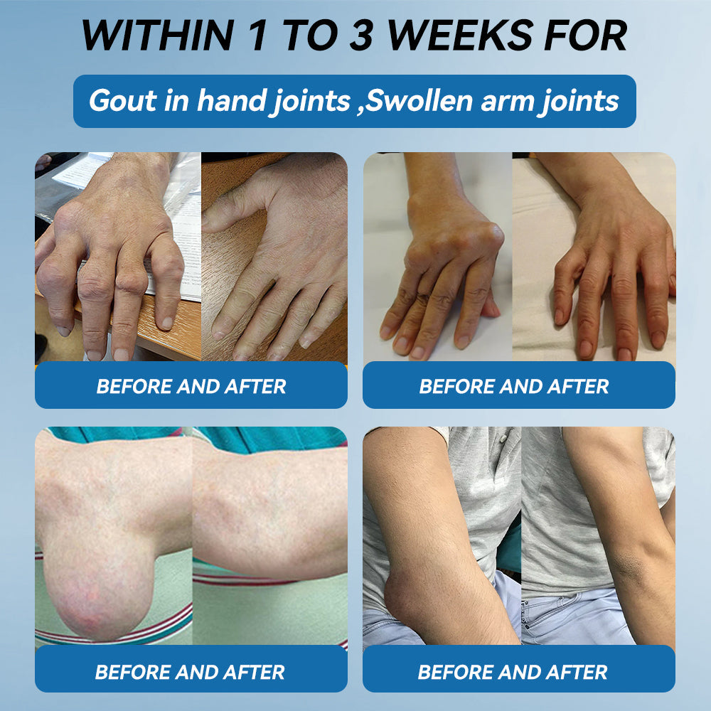 𝖯𝗂𝖼𝗱𝗼®🦹🦹 BPC-157 Joint Healing Cream🦴Treats Arthritis, Neuropathy, Rheumatism, Sports Injuries & More👍