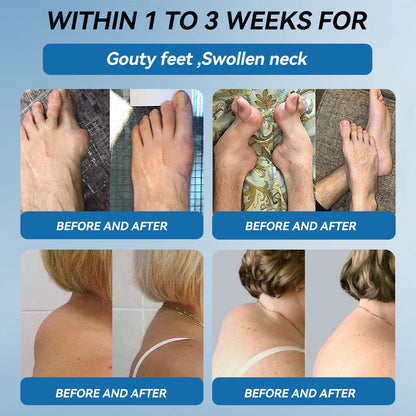 𝖯𝗂𝖼𝗱𝗼®🦹🦹 BPC-157 Joint Healing Cream🦴Treats Arthritis, Neuropathy, Rheumatism, Sports Injuries & More👍