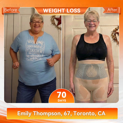 PAURAJU® 🍚✈️30-Min All-in-One Micro-Particle Fat-Burning Shorts✅Ignites deep microcirculation to melt fat, flush toxins, and reverse metabolic aging.