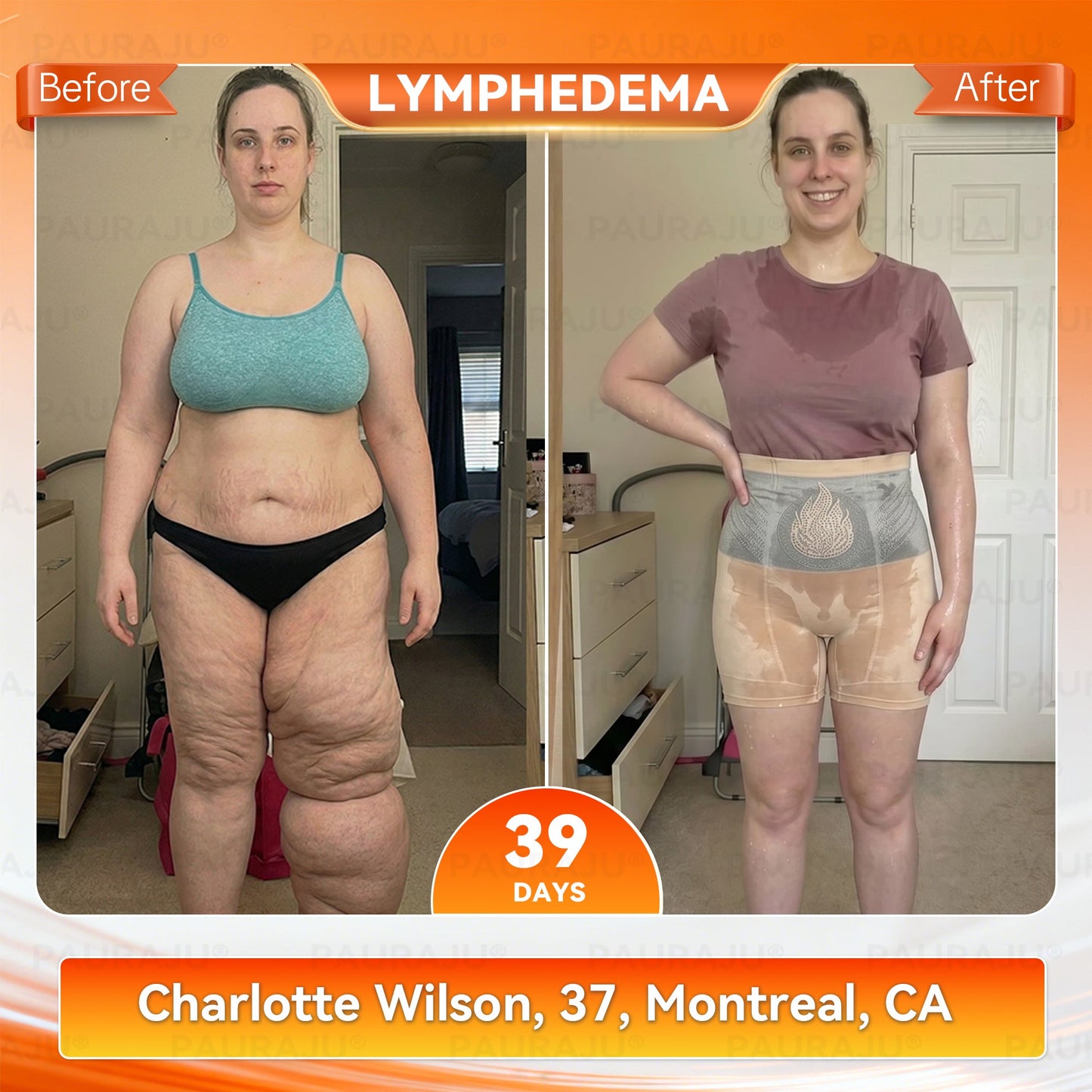 PAURAJU® 🍚✈️30-Min All-in-One Micro-Particle Fat-Burning Shorts✅Ignites deep microcirculation to melt fat, flush toxins, and reverse metabolic aging.