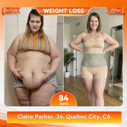 PAURAJU® 🥨✈️30-Min All-in-One Micro-Particle Fat-Burning Shorts✅Ignites deep microcirculation to melt fat, flush toxins, and reverse metabolic aging.