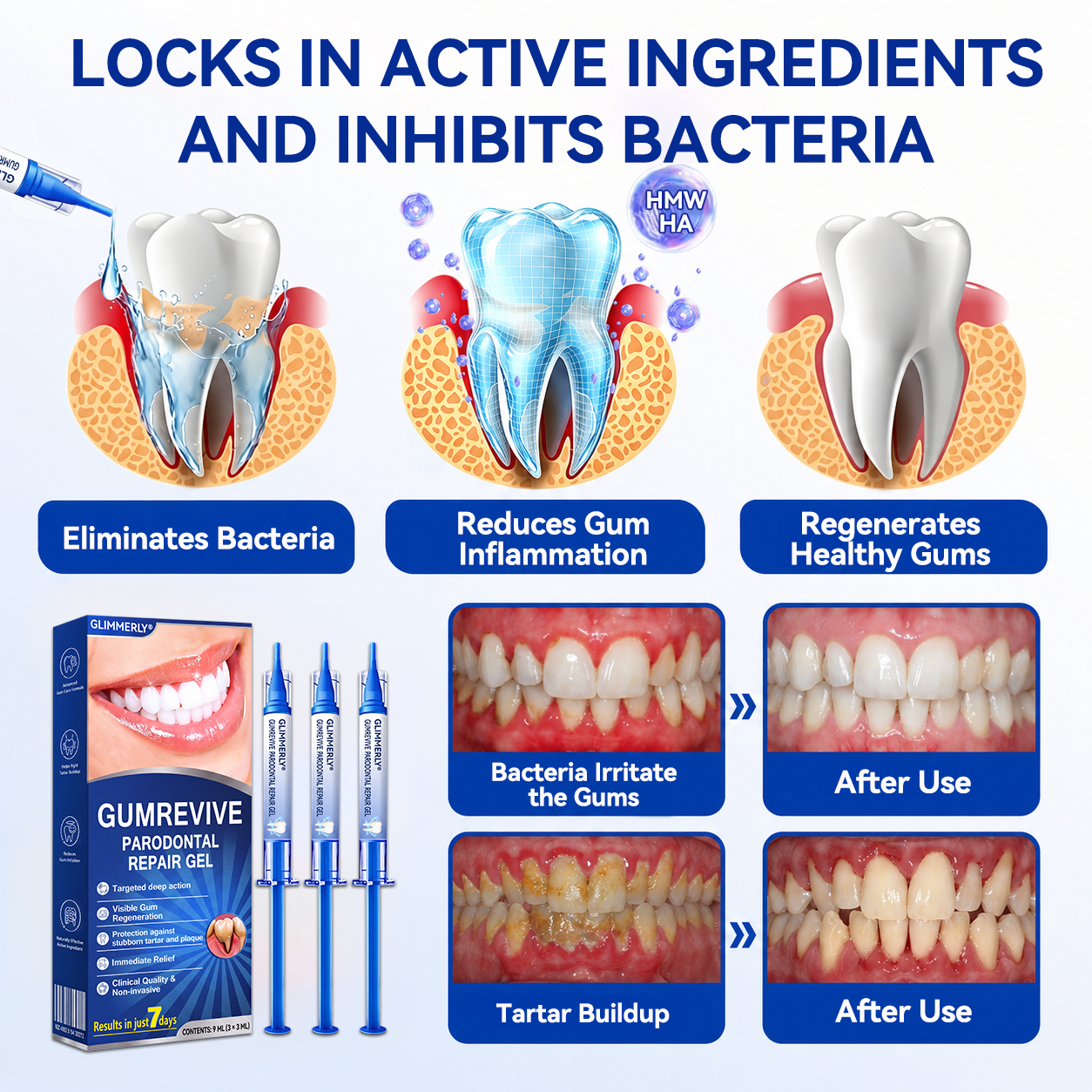 🦷𝑮𝒍𝒊𝒎𝒎𝒆𝒓𝒍𝒚® 𝑮𝒖𝒎𝑹𝒆𝒗𝒊𝒗𝒆 𝑷𝒆𝒓𝒊𝒐𝒅𝒐𝒏𝒕𝒂𝒍 𝑹𝒆𝒑𝒂𝒊𝒓 𝑮𝒆𝒍